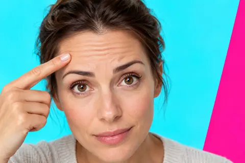 Botox guide — forehead and eyebrow expression lines