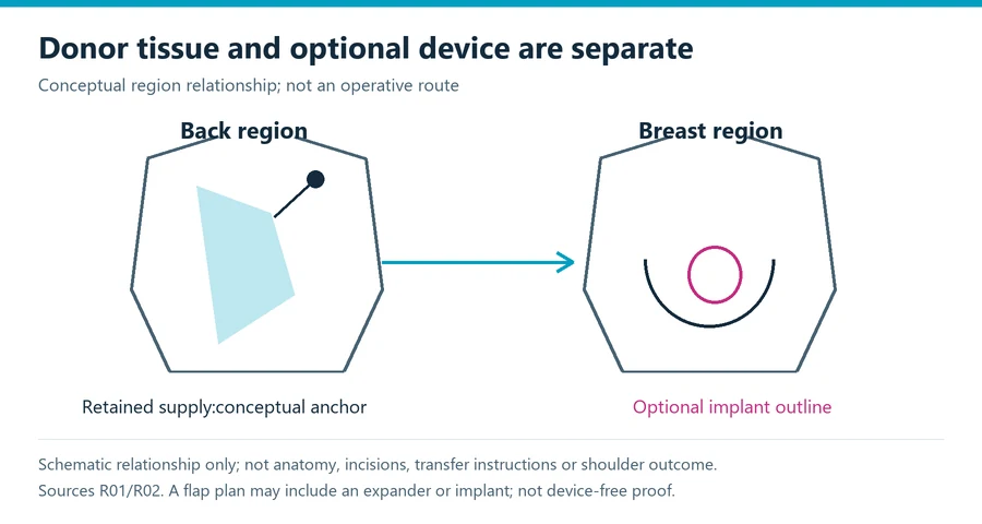 Latissimus flap reconstruction conceptual diagram linking the back donor tissue to breast reconstruction while showing the retained blood supply and a separately labeled optional implant